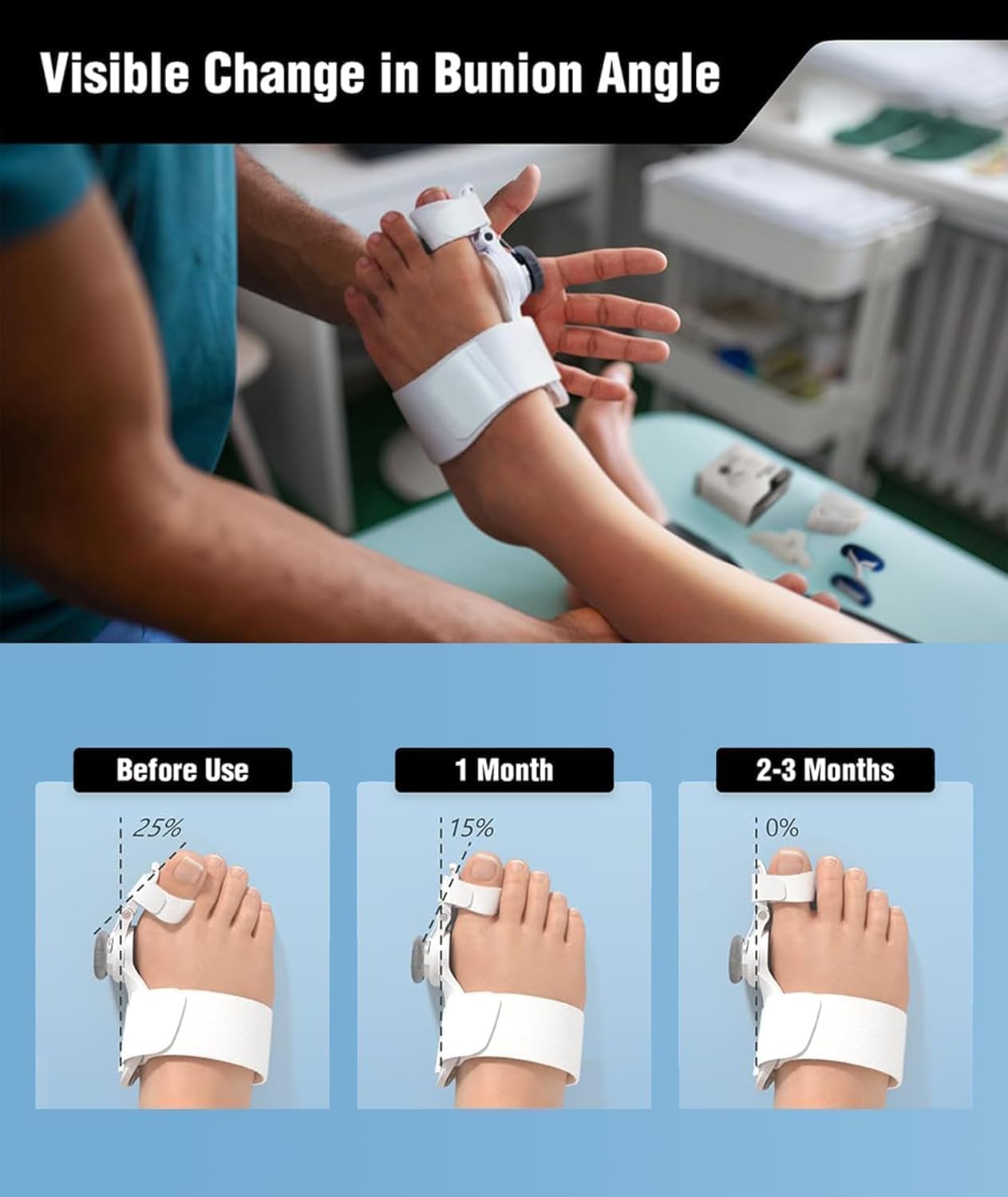 Fuxin' Bunion Corrector Kit with Toe Separator for Bunion Relief, Day Night Support Orthopedic Bunion Toe Straightener, Adjustable Bunion Splint for Women and Men